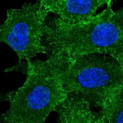 MRP3 Antibody, Novus Biologicals 0.1mL; Unlabeled:Antibodies, Polyclonal