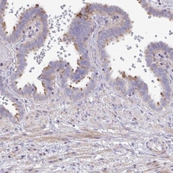 MRP3 Antibody, Novus Biologicals 0.1mL; Unlabeled:Antibodies, Polyclonal