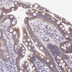 MRP3 Antibody, Novus Biologicals 0.1mL; Unlabeled:Antibodies, Polyclonal