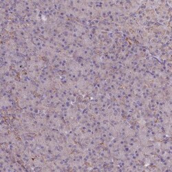 MRP63 Antibody, Novus Biologicals:Antibodies:Primary Antibodies