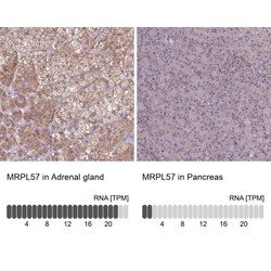 MRP63 Antibody, Novus Biologicals:Antibodies:Primary Antibodies