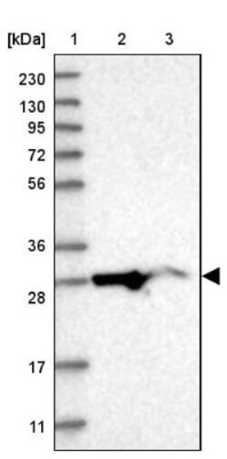 MRPL10 Antibody, Novus Biologicals 25 &mu;L; Unlabeled:Antibodies, Polyclonal