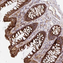 MRPL13 Antibody, Novus Biologicals 0.1mL; Unlabeled:Antibodies, Polyclonal