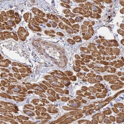 MRPL15 Antibody, Novus Biologicals 0.1mL; Unlabeled:Antibodies, Polyclonal