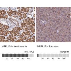 MRPL15 Antibody, Novus Biologicals 0.1mL; Unlabeled:Antibodies, Polyclonal