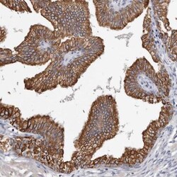 MRPL18 Antibody, Novus Biologicals 0.1mL; Unlabeled:Anticorps, Polyclonal