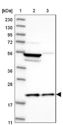 MRPL18 Antibody, Novus Biologicals 0.1 mL | Buy Online | Novus Biologicals | Fisher Scientific
