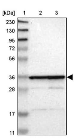 MRPL2 Antibody, Novus Biologicals 0.1mL; Unlabeled:Antibodies, Polyclonal