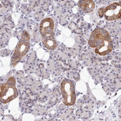MRPL21 Antibody, Novus Biologicals:Antibodies:Primary Antibodies