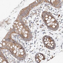 MRPL24 Antibody, Novus Biologicals:Antibodies:Primary Antibodies