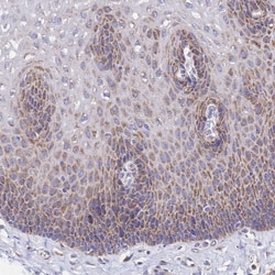 MRPL3 Antibody, Novus Biologicals 0.1mL; Unlabeled:Antibodies, Polyclonal