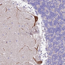MRPL3 Antibody, Novus Biologicals 0.1mL; Unlabeled:Antibodies, Polyclonal