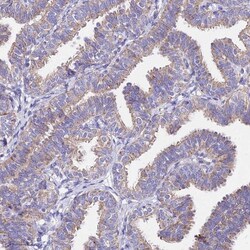 MRPL3 Antibody, Novus Biologicals 0.1mL; Unlabeled:Antibodies, Polyclonal
