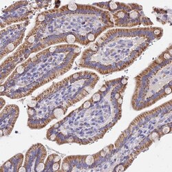 MRPL3 Antibody, Novus Biologicals 0.1mL; Unlabeled:Antibodies, Polyclonal