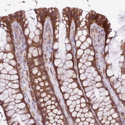 MRPL36 Antibody, Novus Biologicals:Antibodies:Primary Antibodies