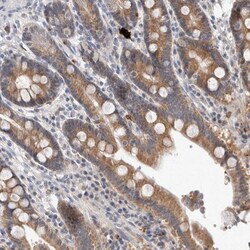 MRPL37 Antibody, Novus Biologicals:Antibodies:Primary Antibodies