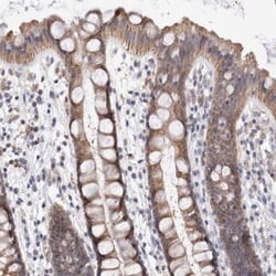 MRPL37 Antibody, Novus Biologicals:Antibodies:Primary Antibodies