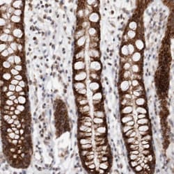 MRPL37 Antibody, Novus Biologicals 25 &mu;L | Buy Online | Novus Biologicals | Fisher Scientific