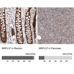 MRPL37 Antibody, Novus Biologicals 25 &mu;L | Buy Online | Novus Biologicals | Fisher Scientific