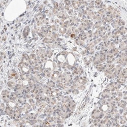 MRPL37 Antibody, Novus Biologicals 0.1mL; Unlabeled:Antibodies, Polyclonal