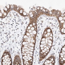 MRPL37 Antibody, Novus Biologicals 0.1mL; Unlabeled:Antibodies, Polyclonal
