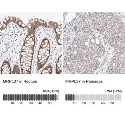MRPL37 Antibody, Novus Biologicals 0.1mL; Unlabeled:Antibodies, Polyclonal
