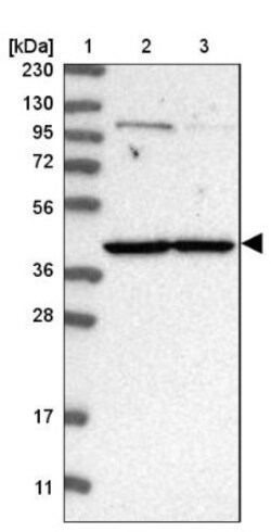 MRPL37 Antibody, Novus Biologicals 0.1mL; Unlabeled:Antibodies, Polyclonal