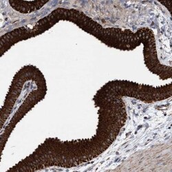 MRPL38 Antibody, Novus Biologicals 0.1mL; Unlabeled:Antibodies, Polyclonal
