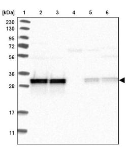 MRPL45 Antibody, Novus Biologicals 0.1mL; Unlabeled:Antibodies, Polyclonal