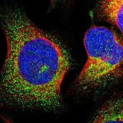 MRPL50 Antibody, Novus Biologicals 0.1mL; Unlabeled:Antibodies, Polyclonal