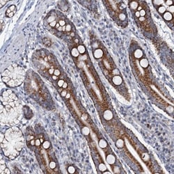 MRPL51 Antibody, Novus Biologicals 25 &mu;L; Unlabeled:Antibodies, Polyclonal