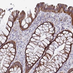 MRPL53 Antibody, Novus Biologicals 25 &mu;L, Unlabeled:Antibodies, Polyclonal