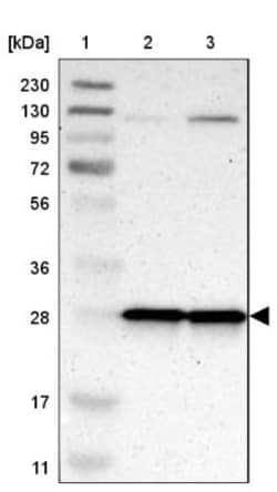 MRPL9 Antibody, Novus Biologicals 0.1mL; Unlabeled:Antibodies, Polyclonal