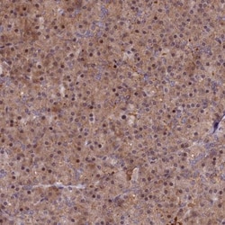 MRPS11 Antibody, Novus Biologicals 0.1mL; Unlabeled:Antibodies, Polyclonal