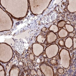 MRPS11 Antibody, Novus Biologicals 0.1mL; Unlabeled:Antibodies, Polyclonal