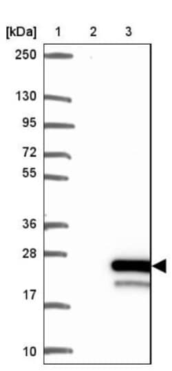 MRPS11 Antibody, Novus Biologicals 0.1mL; Unlabeled:Antibodies, Polyclonal