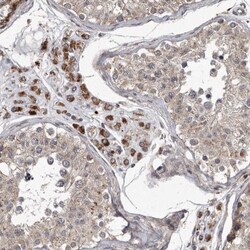 MRPS15 Antibody, Novus Biologicals:Antibodies:Primary Antibodies