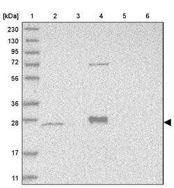 MRPS15 Antibody, Novus Biologicals:Antibodies:Primary Antibodies
