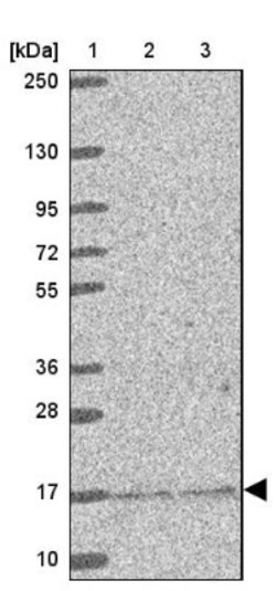 MRPS16 Antibody, Novus Biologicals:Antibodies:Primary Antibodies