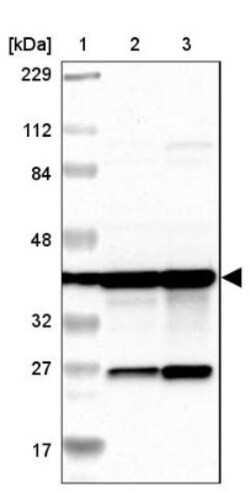GMPPA Antibody, Novus Biologicals:Antibodies:Primary Antibodies