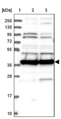 MRPS35 Antibody, Novus Biologicals 0.1mL; Unlabeled:Antibodies, Polyclonal