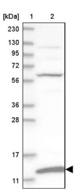 MRPS36 Antibody, Novus Biologicals 25 μL; Unlabeled:Antibodies, Polyclonal