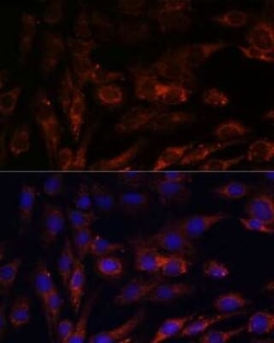 MRPS7 Rabbit anti-Human, Mouse, Rat, Polyclonal, Novus Biologicals 20 &mu;g | Buy Online | Novus Biologicals | Fisher Scientific