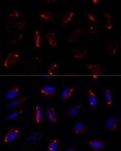 MRPS7 Rabbit anti-Human, Mouse, Rat, Polyclonal, Novus Biologicals 20 &mu;g | Buy Online | Novus Biologicals | Fisher Scientific