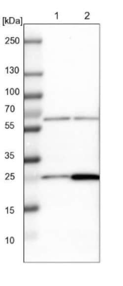 MRPS7 Antibody, Novus Biologicals 25 &mu;L; Unlabeled:Antibodies, Polyclonal