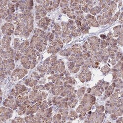 MRPS9 Antibody, Novus Biologicals:Antibodies:Primary Antibodies