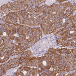MRPS9 Antibody, Novus Biologicals:Antibodies:Primary Antibodies