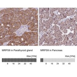 MRPS9 Antibody, Novus Biologicals:Antibodies:Primary Antibodies
