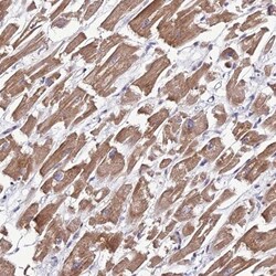 MRPS9 Antibody, Novus Biologicals 25 &mu;L, Unlabeled:Antibodies, Polyclonal