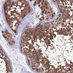 MRPS9 Antibody, Novus Biologicals 25 &mu;L, Unlabeled:Antibodies, Polyclonal